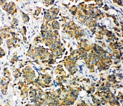 IHC - Anti-PDK2 Antibody ABO11303